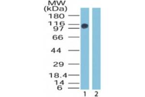 Western Blotting (WB) image for anti-Zinc Finger, MYM-Type 2 (ZMYM2) (AA 1250-1300) antibody (ABIN2469808)