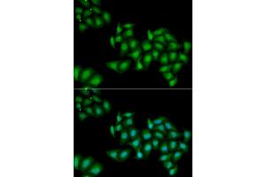 Immunofluorescence (IF) image for anti-DEAD (Asp-Glu-Ala-Asp) Box Polypeptide 1 (DDX1) antibody (ABIN1980256) (DDX1 anticorps)
