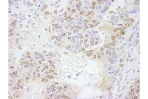 anti-Ets2 Repressor Factor (ERF) (AA 498-548) antibody