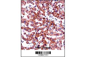 ITGB5 Antibody immunohistochemistry analysis in formalin fixed and paraffin embedded human liver tissue followed by peroxidase conjugation of the secondary antibody and DAB staining.