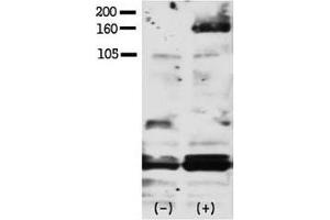 Western blot testing of phospho-HER4 antibody and FG pancreatic carcinoma cells treated with or without EGF (50ng/ml) for 15 min. (ERBB4 anticorps  (pTyr1188))