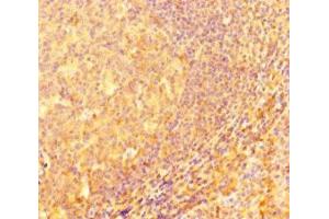 Immunohistochemistry of paraffin-embedded human tonsil tissue using ABIN7156623 at dilution of 1:100 (IRF5 anticorps  (AA 214-395))