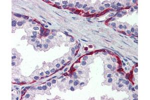 Anti-METTL7A antibody IHC of human prostate. (METTL7A anticorps  (Internal Region))