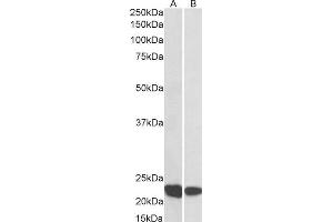 ABIN2564848 (0. (RAC2 anticorps  (C-Term))