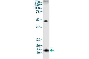 TOMM20 monoclonal antibody (M01), clone 4F3.