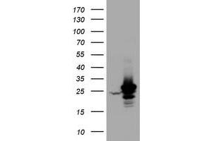 Western Blotting (WB) image for anti-Hydroxysteroid (17-Beta) Dehydrogenase 8 (HSD17B8) (AA 57-261) antibody (ABIN2715557) (HSD17B8 anticorps  (AA 57-261))