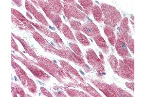 Anti-GPR15 antibody IHC of human heart.