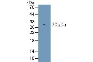 Detection of Recombinant CD226, Human using Monoclonal Antibody to Cluster Of Differentiation 226 (CD226) (CD226 anticorps  (AA 19-254))