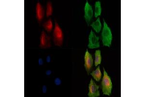 Phospho-PKC theta (Ser695) Antibody staining A549 cells(H2O2 treatment) by IF/ICC. (PKC theta anticorps  (pSer695))