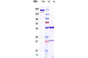 Anti-CTLA-8 / IL-17a Reference Antibody (CAT-2200) on SDS-PAGE under reducing (R) condition.
