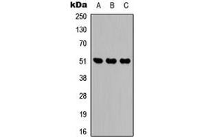 Western blot analysis of IDH2 expression in HEK293T (A), Raw264. (IDH2 anticorps  (Center))