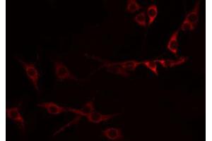 ABIN6274321 staining Hela by IF/ICC.