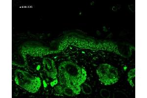 Immunohistochemistry analysis using Rabbit Anti-SOD2 Polyclonal Antibody (ABIN361655 and ABIN361656).
