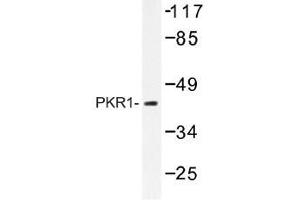 Image no. 1 for anti-Protein Kinase, CAMP-Dependent, Regulatory, Type I, alpha (Tissue Specific Extinguisher 1) (PRKAR1A) antibody (ABIN317770) (PRKAR1A anticorps)