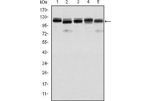 Western blot analysis using BMPR2 mouse mAb against Hela (1), A431 (2), NIH/3T3 (3), Cos7 (4) and PC-12 (5) cell lysate.