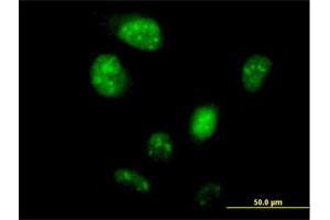 Immunofluorescence of purified MaxPab antibody to LOC148203 on HeLa cell. (ZNF738 anticorps  (AA 1-137))