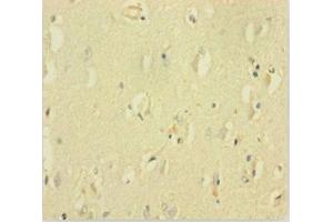 Immunohistochemistry of paraffin-embedded human brain tissue using ABIN7153507 at dilution of 1:100 (GABRQ anticorps  (AA 348-611))
