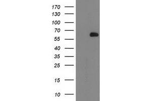 Western Blotting (WB) image for anti-2-Oxoglutarate and Iron-Dependent Oxygenase Domain Containing 1 (OGFOD1) antibody (ABIN1499912) (OGFOD1 anticorps)