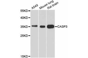 Western blot analysis of extracts of various cell lines, using CASP3 antibody (ABIN5970047) at 1/1000 dilution. (Caspase 3 anticorps)