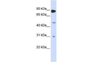 WB Suggested Anti-ADARB1 Antibody Titration:  0. (RED1 anticorps  (N-Term))