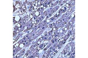 IHC analysis of TRAM1L1 using anti-TRAM1L1 antibody (ABIN7602939). (TRAM1L1 anticorps  (C-Term))