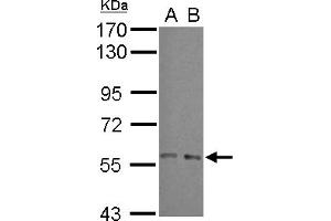 Western Blotting (WB) image for anti-ADP-Ribosylation Factor GTPase Activating Protein 3 (ARFGAP3) (N-Term) antibody (ABIN1493987) (ARFGAP3 anticorps  (N-Term))