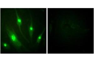 Immunofluorescence analysis of HeLa cells, using GTPase Activating Protein (Ab-387) Antibody. (RACGAP1 anticorps  (AA 353-402))