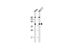 Western Blot at 1:1000 dilution Lane 1: Hela whole cell lysate Lane 2: MCF-7 whole cell lysate Lysates/proteins at 20 ug per lane. (ACTR2 anticorps  (C-Term))