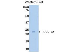 Western Blotting (WB) image for anti-Collagen, Type XVIII (COL18) (AA 1591-1774) antibody (ABIN1077946) (COL18 anticorps  (AA 1591-1774))