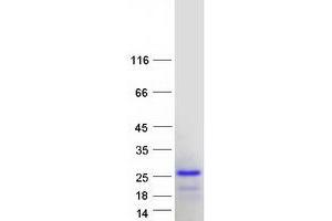 Validation with Western Blot