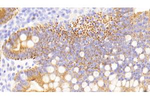 Detection of CK13 in Human Small intestine Tissue using Polyclonal Antibody to Cytokeratin 13 (CK13)