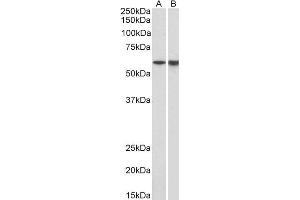 ABIN987272 (1µg/ml) staining of Pig Bone Marrow (A) and Spleen (B) lysates (35µg protein in RIPA buffer).