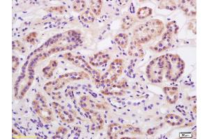 Formalin-fixed and paraffin embedded rat kidney labeled with Anti-Alpha-ENaC Polyclonal Antibody, Unconjugated (ABIN682243) at 1:200 followed by conjugation to the secondary antibody and DAB staining.