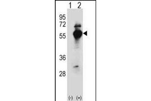 Western blot analysis of DARS (arrow) using rabbit polyclonal DARS Antibody (N-term) (ABIN655040 and ABIN2844671).
