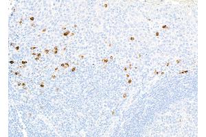 Immunohistochemistry (IHC) image for anti-CD80 (CD80) (AA 35-246) antibody (ABIN7449415) (Recombinant CD80 anticorps  (AA 35-246))