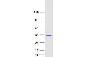Validation with Western Blot