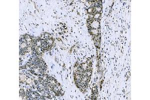 IHC analysis of CSNK2B using anti-CSNK2B antibody (ABIN7599092). (CSNK2B anticorps  (AA 1-215))