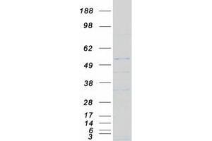 Validation with Western Blot