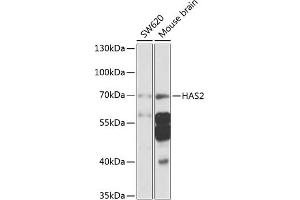 Western blot analysis of extracts of various cell lines, using H antibody (ABIN6129690, ABIN6141613, ABIN6141614 and ABIN6225245) at 1:1000 dilution.