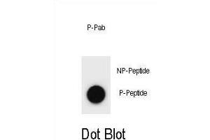 Dot blot analysis of E Antibody (Phospho ) Phospho-specific Pab (ABIN1881299 and ABIN2839953) on nitrocellulose membrane. (p300 anticorps  (pSer1834))