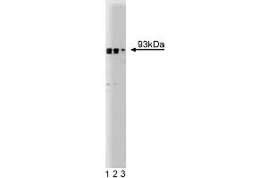 Western blot analysis of Gelsolin on human endothelial cell lysate. (Gelsolin anticorps  (AA 592-768))