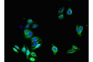 Immunofluorescent analysis of HepG2 cells using ABIN7144495 at dilution of 1:100 and Alexa Fluor 488-congugated AffiniPure Goat Anti-Rabbit IgG(H+L)