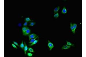 Immunofluorescent analysis of HepG2 cells using ABIN7144495 at dilution of 1:100 and Alexa Fluor 488-congugated AffiniPure Goat Anti-Rabbit IgG(H+L) (Aquaporin 1 anticorps  (AA 2-269))