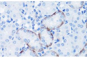 Immunohistochemistry of paraffin-embedded Mouse kidney using Phospho-P70 S6K(T389) Polyclonal Antibody at dilution of 1:100 (40x lens).