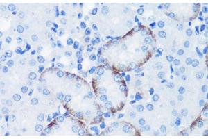 Immunohistochemistry of paraffin-embedded Mouse kidney using Phospho-P70 S6K(T389) Polyclonal Antibody at dilution of 1:100 (40x lens). (RPS6KB1 anticorps  (pThr389))