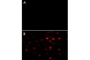 A : Negative control of HeLa cells without Alexa-Fluor-546-conjugated donkey anti-rabbit lgG (H+L). (PKM2 anticorps  (AA 483-513))