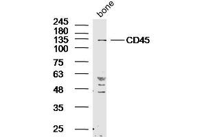 Rat bone lysates probed with Rabbit Anti-CD45 Polyclonal Antibody, Unconjugated  at 1:300 in 4˚C overnight.