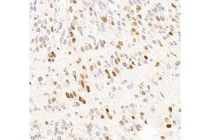 Immunohistochemistry of paraffin embedded mouse embryonic mouse using OTX2 (ABIN7074952) at dilution of 1:600 (400x lens)