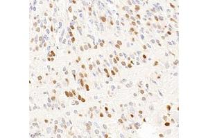 Immunohistochemistry of paraffin embedded mouse embryonic mouse using OTX2 (ABIN7074952) at dilution of 1:600 (400x lens) (OTX2 anticorps)