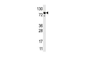 anti-Epidermal Growth Factor Receptor Pathway Substrate 15 (EPS15) (AA 840-870), (C-Term) antibody